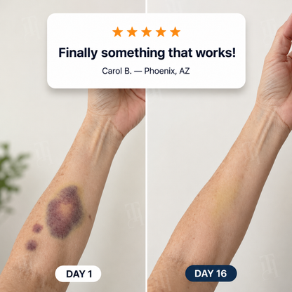 AEXZR® Bruise Repair + SPF 30 Skin-Strengthening Cream🌿🌿 Finally, skincare that works with your skin, not against it.